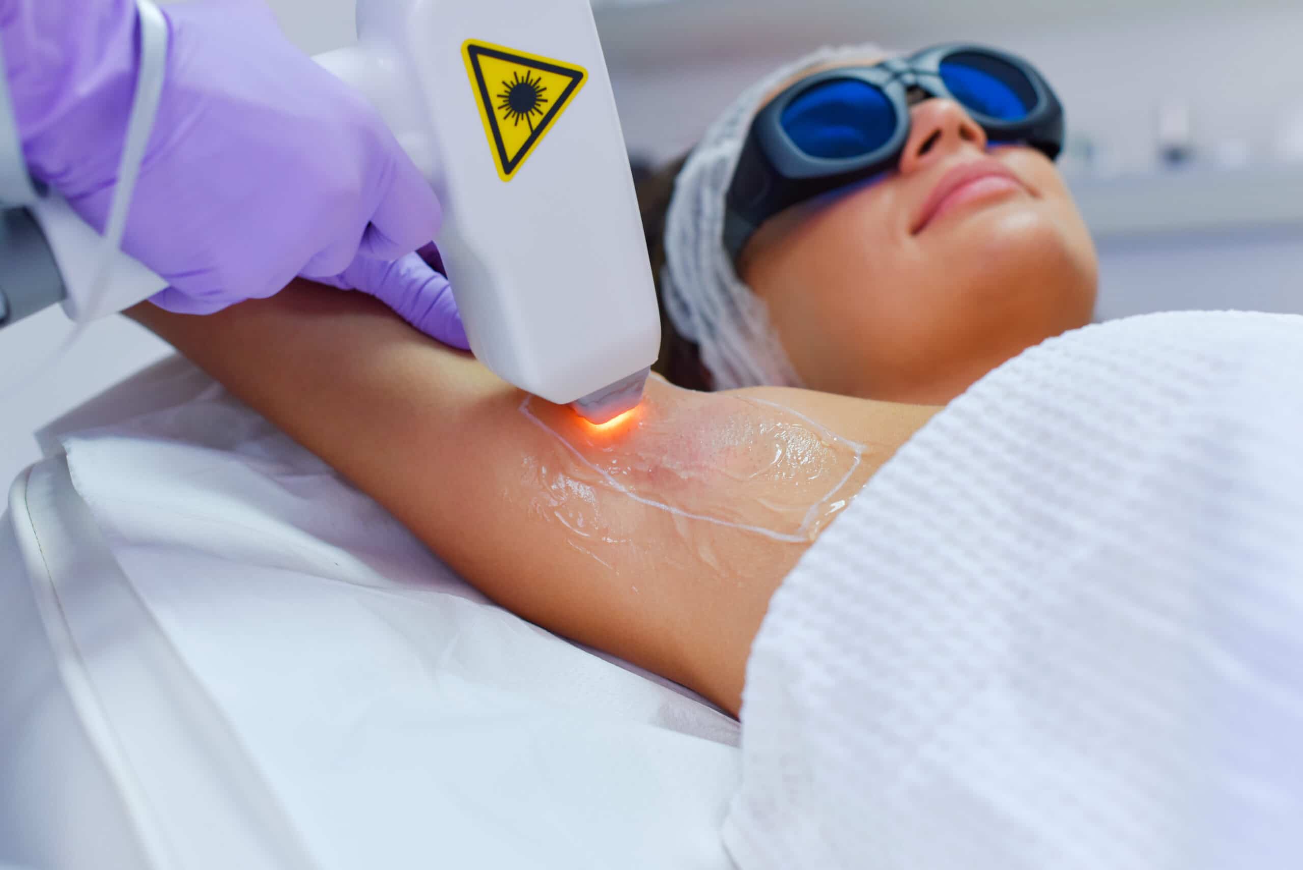 IPL Hair Removal